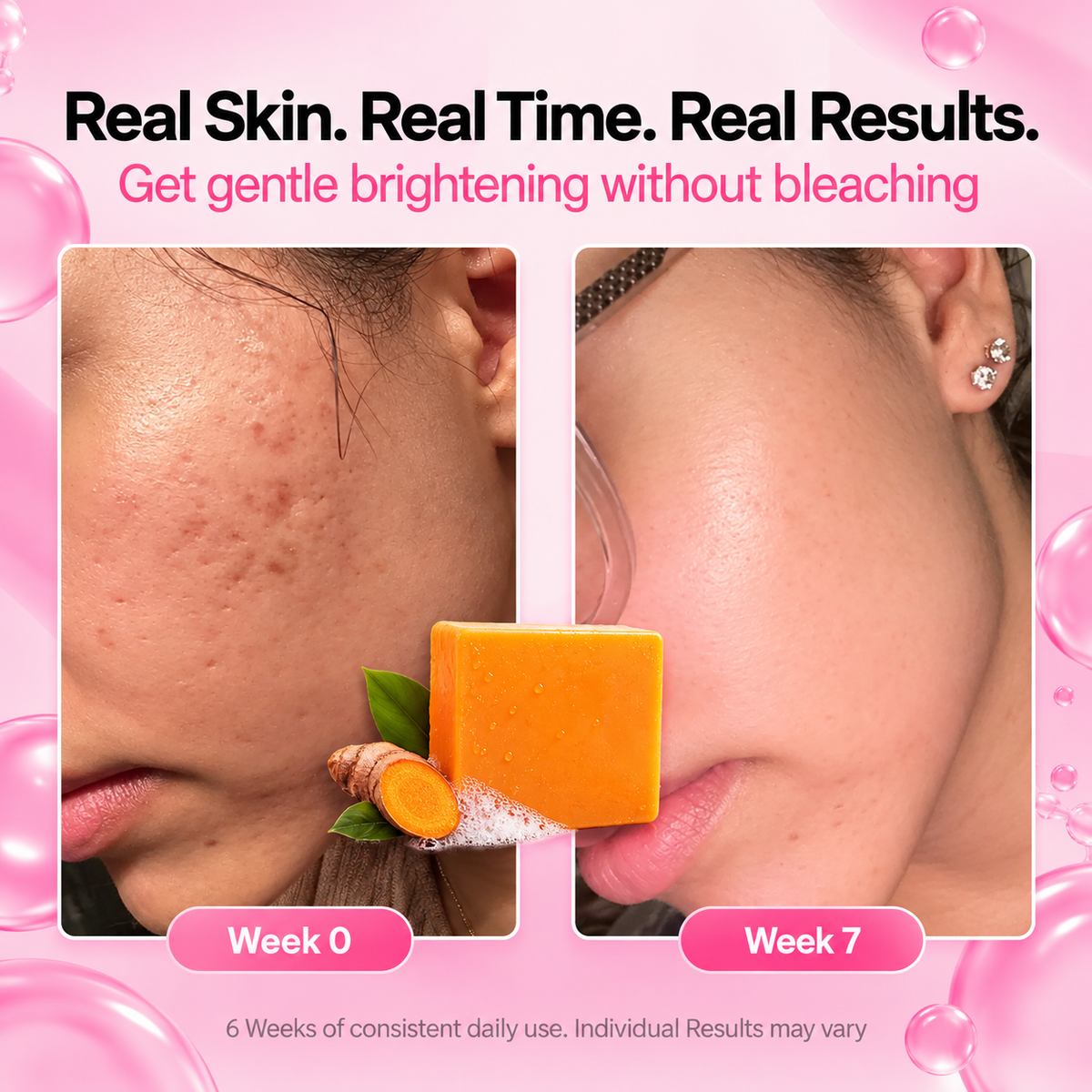 Kojic Acid & Turmeric Soap