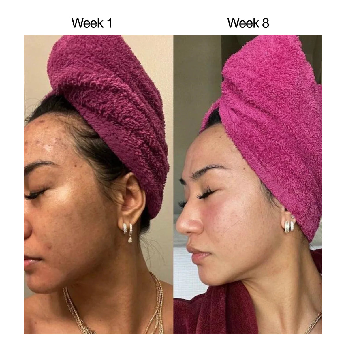 Kojic Acid & Turmeric Soap